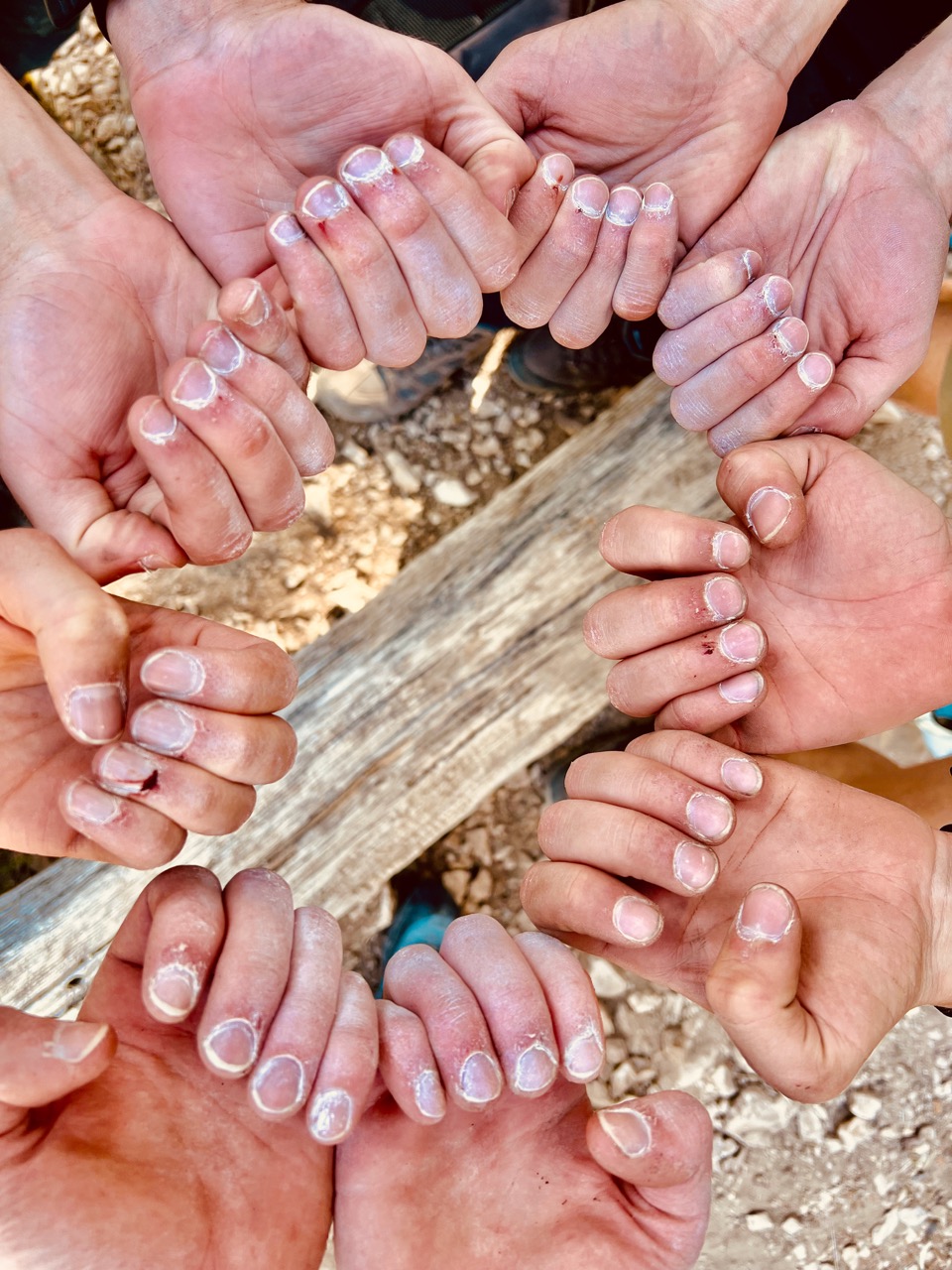 The result of 6 days of cuticle abuse.
